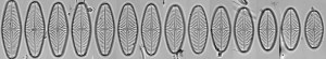 navicula_reinhardtii_valves