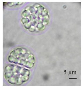 圖12. Aurantiochytrium limacinum（不知道中文叫什么，可以看到細胞里一個個油滴，by Abad &Turon, 2015）